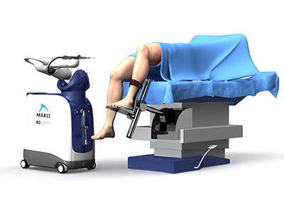 Robotic Assisted Knee Replacement - Educational Picture