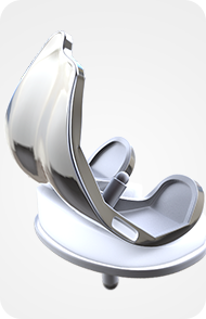 Outpatient Knee Replacement