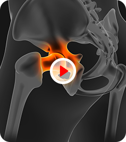 Patient Education Videos