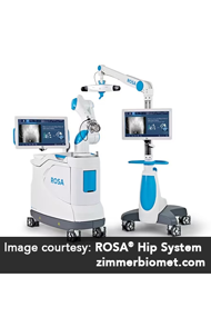 ROSA Robotic-Assisted Hip Replacement