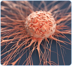 Colon Cancer Screening pic
