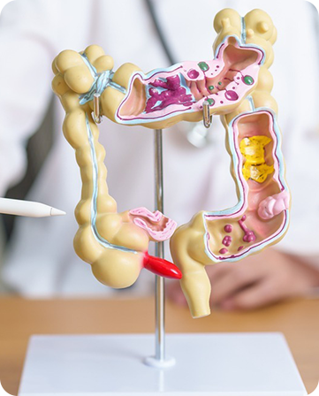 Colon & Colorectal Img