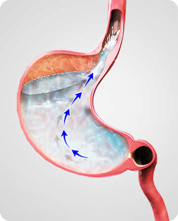 Gastrointestinal Conditions Img