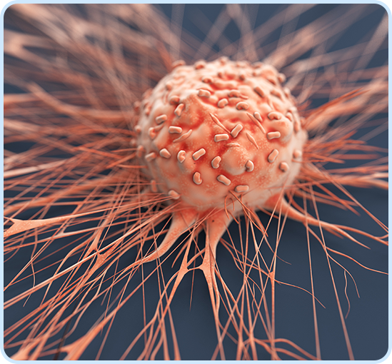 Colorectal Cancer Img