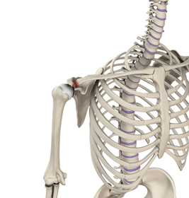 Acromioclavicular (AC) Joint Injuries - Educational Picture