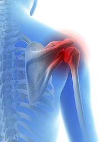 Baseball and Shoulder Injuries - Educational Picture