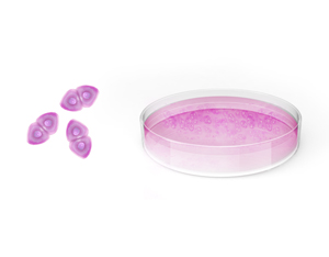 Cartilage Restoration - Educational Picture