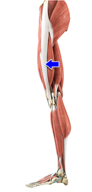 Iliotibial Band Syndrome - Educational Picture