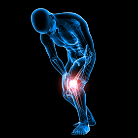 Joint Injuries - Educational Picture