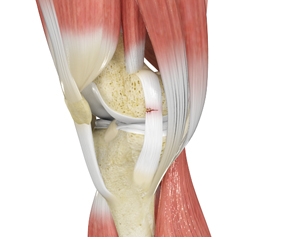 Ligament Injuries - Educational Picture