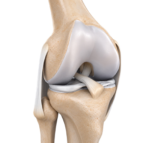 Multiligament Instability - Educational Picture
