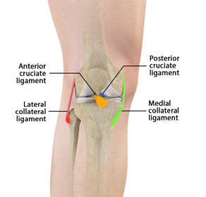 Multiligament Knee Injuries - Educational Picture