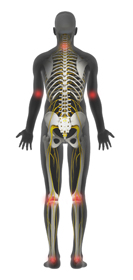 Muscle and Joint Pain - Educational Picture