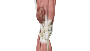 Musculoskeletal Injuries - Educational Picture