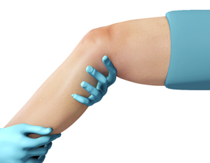 Physical Therapy for Knee  - Educational Picture