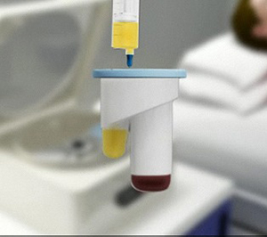 Platelet-Rich Plasma (PRP) for the Shoulder - Educational Picture