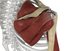 Shoulder Ligament Injuries - Educational Picture