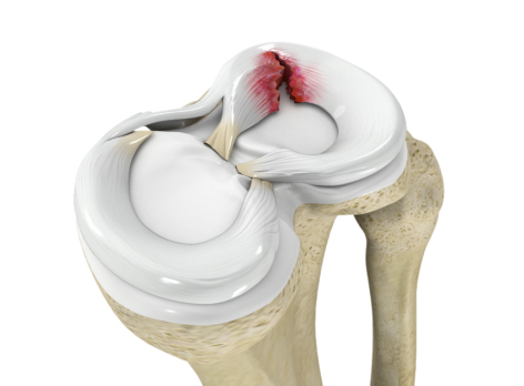 Sports Injury Evaluation - Educational Picture