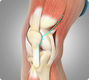 Minimally Invasive img