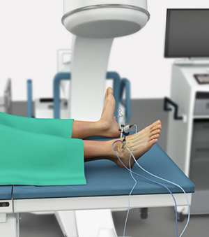 Ankle Arthroscopy - image