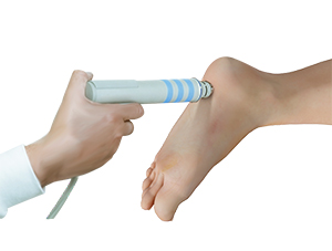 Extracorporeal Shockwave Therapy (ESWT)