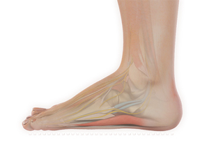 Flatfoot Reconstruction - image