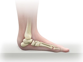 Pediatric Foot Conditions - image
