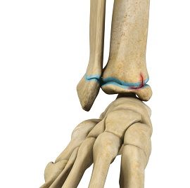 Pediatric Fractures of the Foot & Ankle - image