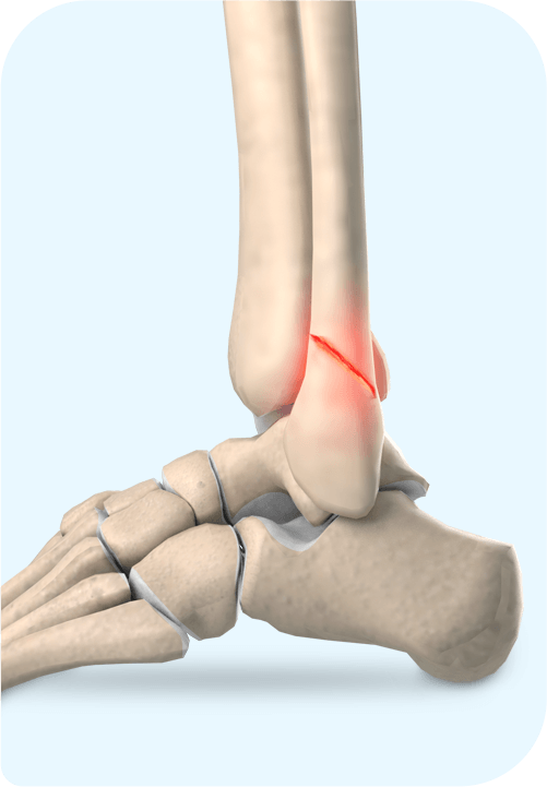 Trauma Surgery