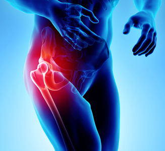 Hip Pain - Educational Picture