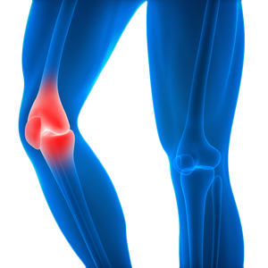 Knee Injury - Educational Picture