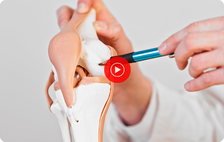 Patient Education Video