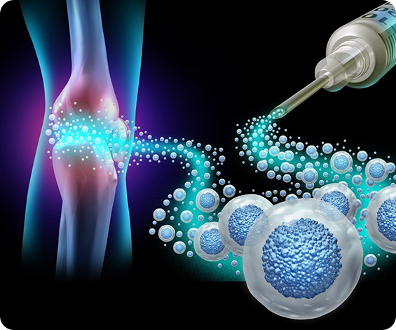 Nonsurgical Arthritis - Service