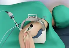 Elbow Arthroscopy Images