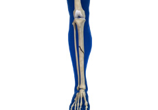 Fractures of the Tibia Images