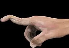 Mallet Finger Images