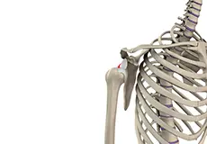 Shoulder Dislocation Images