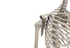 Shoulder Instability Images
