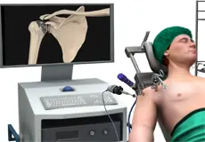 Shoulder Surgery Images