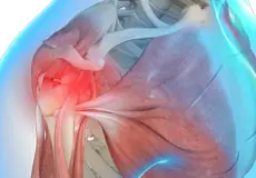 Shoulder Trauma Images
