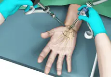 Wrist Arthroscopy Images