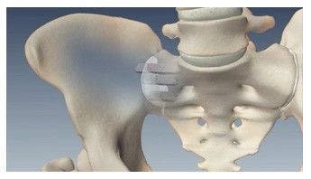 sacroiliac joint
