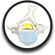 Posterior Cervical Laminoplasty
