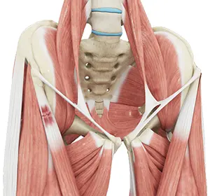 Hip Tendonitis