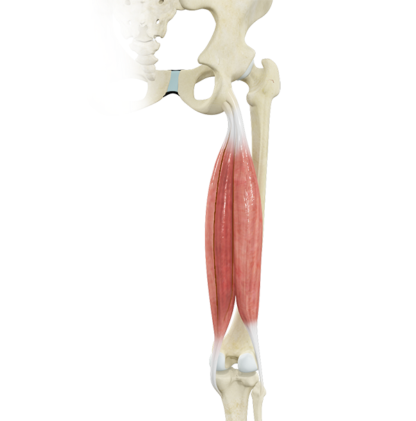 Proximal Hamstring Repair