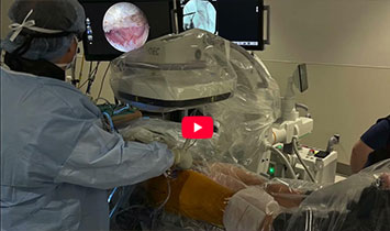 Arthroscopic Hip T-Capsulotomy and Cam Lesion Resection
