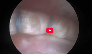 Circumferential Recon Seal Demonstration