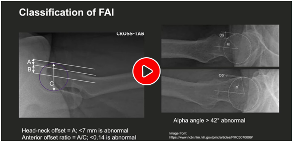 Patient Educational Videos - Educational Picture