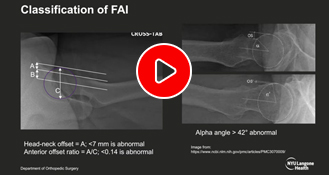 Surgical Videos - Educational Picture