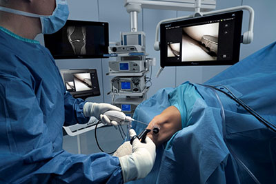 Nanoscopic Surgery at Mammoth Orthopedic Institute Img4